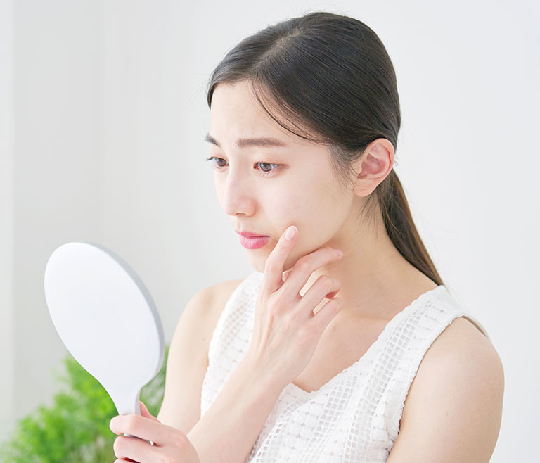 にきびの治療に力を入れています