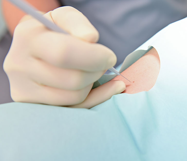 小手術や処置もお気軽に