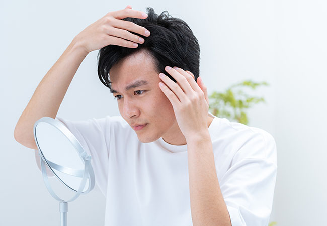 薄毛治療