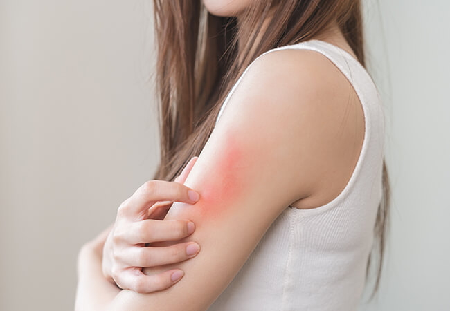 かゆみで肌をかく女性