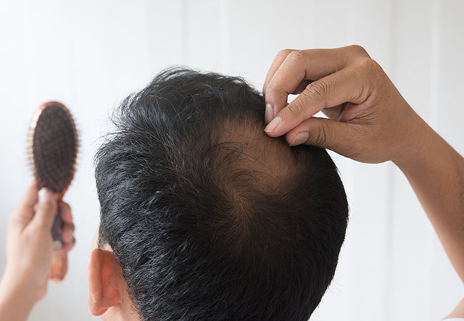 毛・爪・汗のお悩み