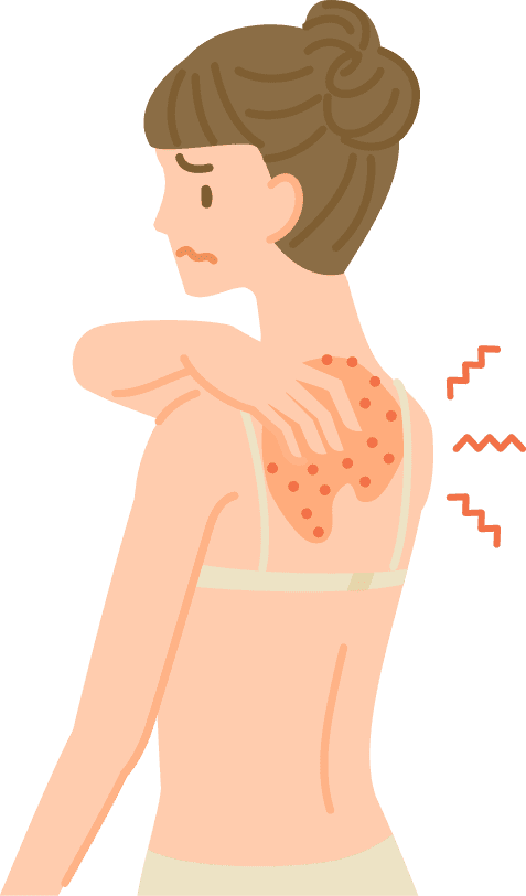 かゆみのお悩み