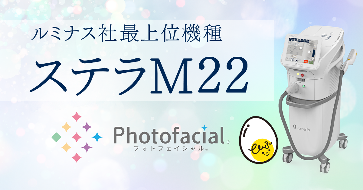Stellar M22(ステラM22)