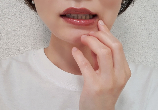 口の周りにピリピリとした痛みが‥「口唇ヘルペス」の初期治療の重要性